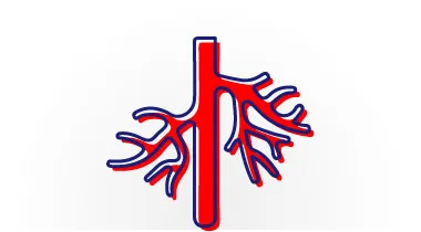 Procedimiento endovascular