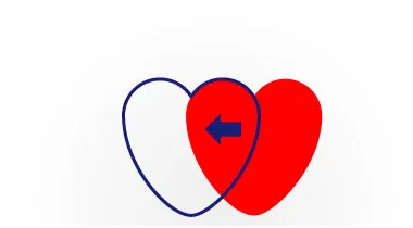 Cirugía de trasplante de corazón